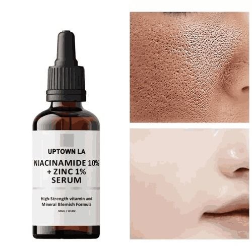 UPTOWN LA Niacinamide Serum Price in Pakistan